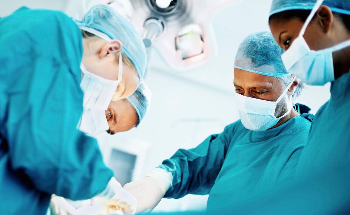 Proces zvětšení penisu chirurgy pomocí operace